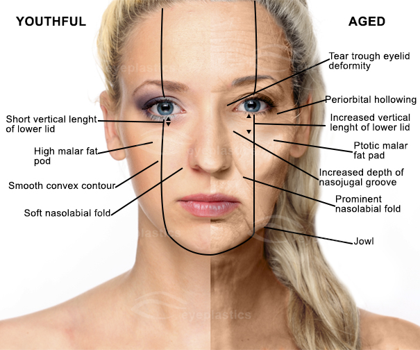 Image depicting a comparison between a youthful and aged face with a watermark.
